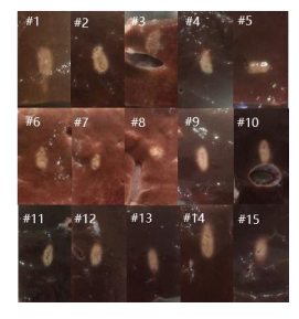 该系统所检测出的离体牛肝组织损伤图